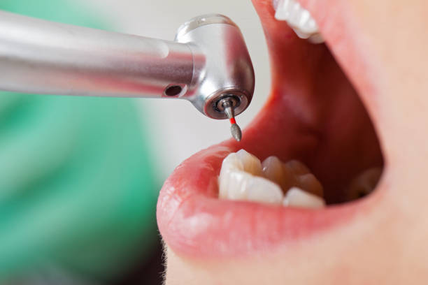 Best Emergency Root Canal Therapy in Oxon Hill, MD